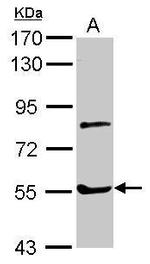 Myotilin Antibody in Western Blot (WB)