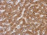 BAAT Antibody in Immunohistochemistry (Paraffin) (IHC (P))