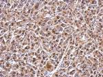 GGCX Antibody in Immunohistochemistry (Paraffin) (IHC (P))