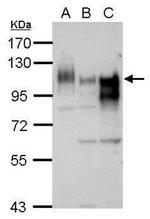 GGCX Antibody in Western Blot (WB)
