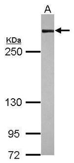 Filamin A alpha-1 Polyclonal Antibody