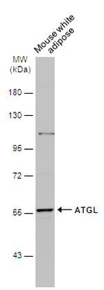 ATGL Polyclonal Antibody