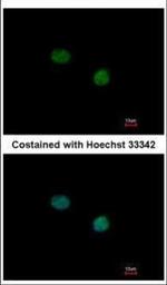 TTF2 Polyclonal Antibody