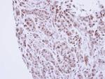 TTF2 Antibody in Immunohistochemistry (Paraffin) (IHC (P))