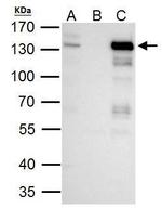 TTF2 Antibody in Immunoprecipitation (IP)