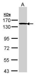 TTF2 Antibody in Western Blot (WB)