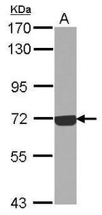 Complement C9 Antibody in Western Blot (WB)