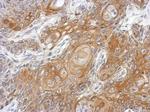 GC Antibody in Immunohistochemistry (Paraffin) (IHC (P))