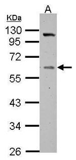 GC Antibody in Western Blot (WB)