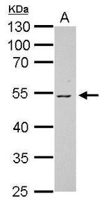 GC Antibody in Western Blot (WB)