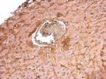 COL6A1 Antibody in Immunohistochemistry (Paraffin) (IHC (P))