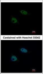 SNW1 Polyclonal Antibody