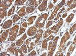 CFHR5 Polyclonal Antibody