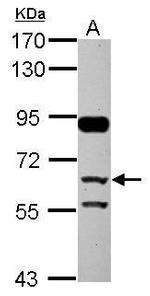 CFHR5 Antibody in Western Blot (WB)