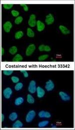 SALL4 Antibody in Immunocytochemistry (ICC/IF)