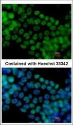 SALL4 Antibody in Immunocytochemistry (ICC/IF)
