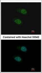 SALL4 Antibody in Immunocytochemistry (ICC/IF)