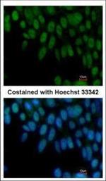 ZIC3 Polyclonal Antibody
