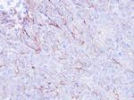 CDKAL1 Polyclonal Antibody