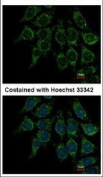 Villin Polyclonal Antibody