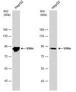 Villin Antibody in Western Blot (WB)
