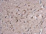 HSPA2 Polyclonal Antibody