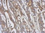 PKC theta Polyclonal Antibody