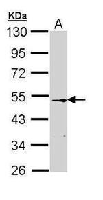 CETP Antibody in Western Blot (WB)