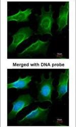 TRAF3 Polyclonal Antibody
