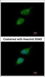 Tara Polyclonal Antibody