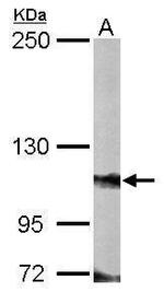 ZFPM2 Polyclonal Antibody