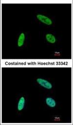 SNW1 Polyclonal Antibody