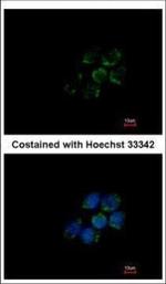 ALDH5A1 Polyclonal Antibody