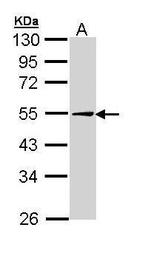 ADFP Antibody in Western Blot (WB)