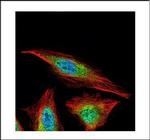 HDAC4 Polyclonal Antibody