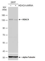 HDAC4 Antibody in Western Blot (WB)
