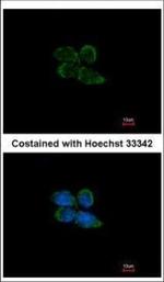 PAPSS2 Polyclonal Antibody