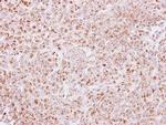PAPSS2 Antibody in Immunohistochemistry (Paraffin) (IHC (P))