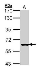 PAPSS2 Antibody in Western Blot (WB)