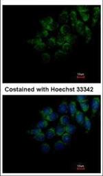 DMP4 Polyclonal Antibody