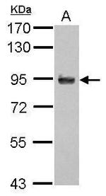 APBB2 Antibody in Western Blot (WB)