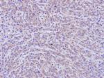 PDE11A Polyclonal Antibody