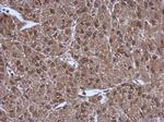 PSMC3 Polyclonal Antibody