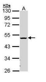 CHST5/CHST6 Polyclonal Antibody