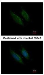 Factor X/Xa Polyclonal Antibody