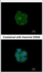 Cytokeratin 13 Polyclonal Antibody
