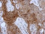Cytokeratin 13 Antibody in Immunohistochemistry (Paraffin) (IHC (P))