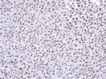 SMC1 Antibody in Immunohistochemistry (Paraffin) (IHC (P))