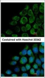 COG8 Polyclonal Antibody