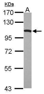 Dynamin 1 Antibody in Western Blot (WB)